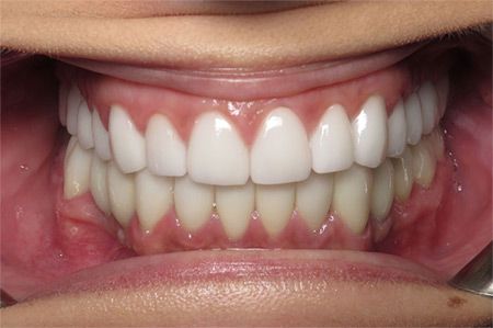 before/after dental treatment